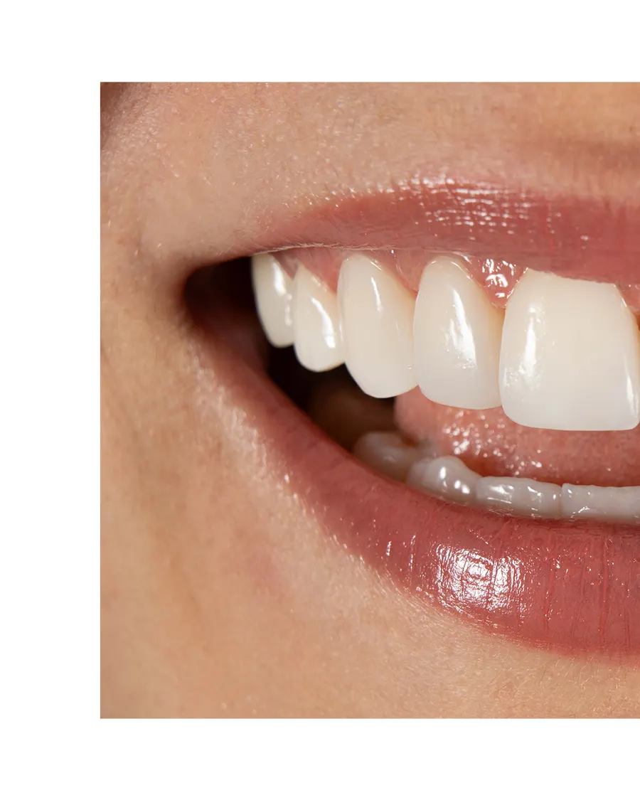 Odontología estética — resultado con armonía facial